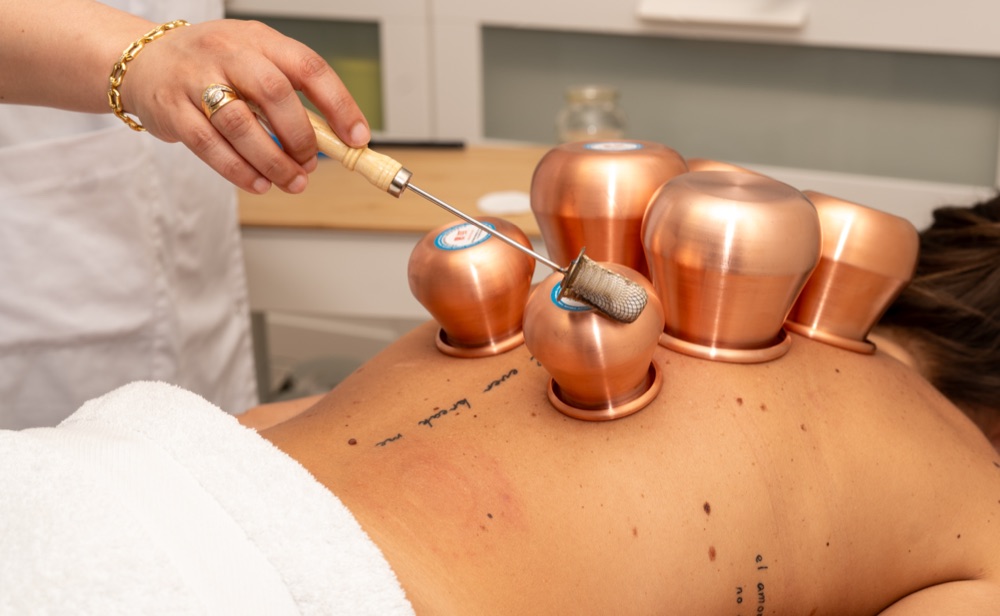 Hijama cupping behandeling