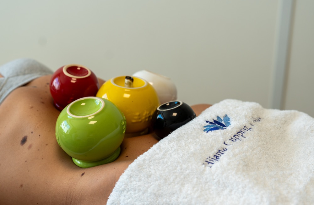 Hijama cupping kleurrijke cups